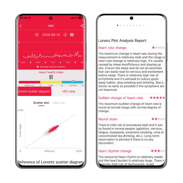 HRV Lorenz Analysis