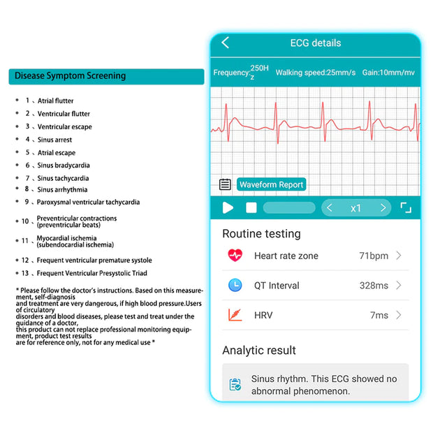 <strong>ECG AI ANALYSIS REPORT</strong>