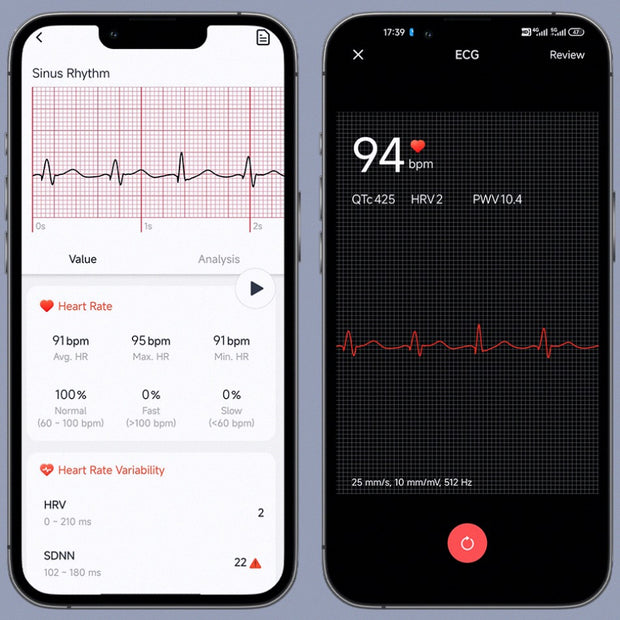 Measure Your ECG Anytime